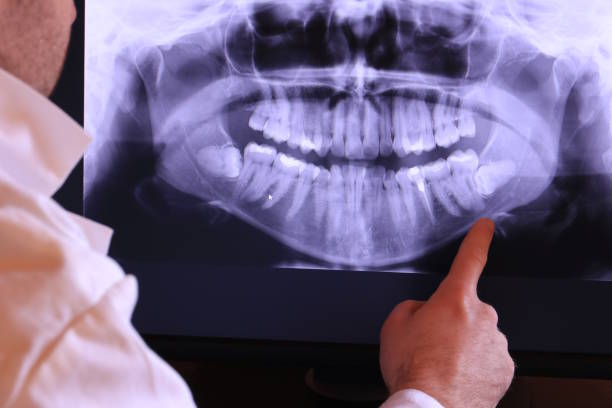 Best Emergency Dental Services for Seniors in Pawcatuck, CT