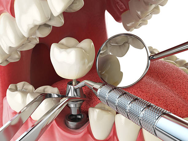 Best Emergency Dentist for Special Needs Patients in Pawcatuck, CT